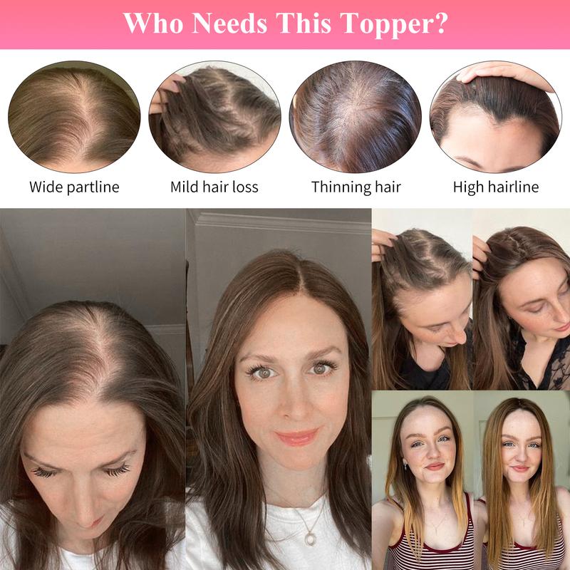 Vasilia Human Hair Topper 10 Inch Hair Toppers for Women Real Hair Toppers Clip in Hair Topper for Women with Thinning Hair Wiglets Hairpieces for Women Hair Loss Solution Add Hair Volume Cover Thinning Hair